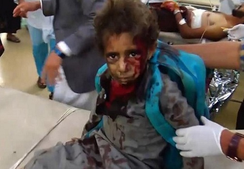 Xe buýt chở học sinh Yemen trúng tên lửa, ít nhất 43 người thiệt mạng