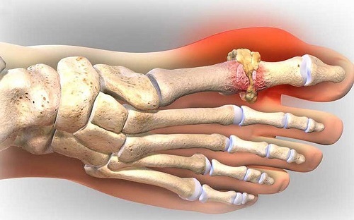 Không chịu tin lời chẩn đoán của bác sĩ, một phụ nữ nôn ra máu nguy kịch