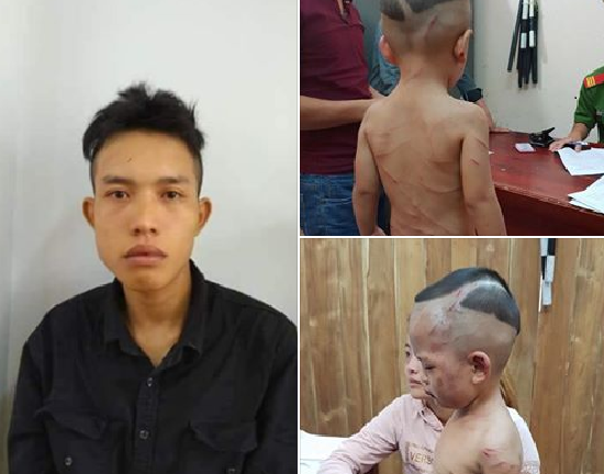 Thông tin mới nhất vụ cháu bé 3 tuổi bị cha dượng hành hung tại Phú Quốc