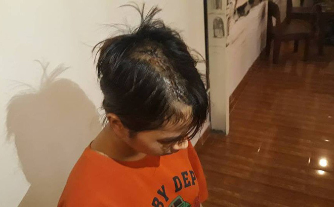 Điều tra vụ thiếu nữ 14 tuổi bị nhóm thanh niên truy sát đến ngất lịm