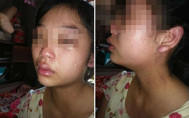 Tin tức đời sống mới nhất ngày 4/10/2018: Vợ 16 tuổi bị chồng siết cổ đánh đập khi vừa sinh con
