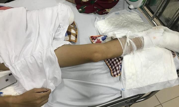 Thanh niên bị truy sát phải cưa chân ở Phú Thọ kể lại giây phút kinh hoàng