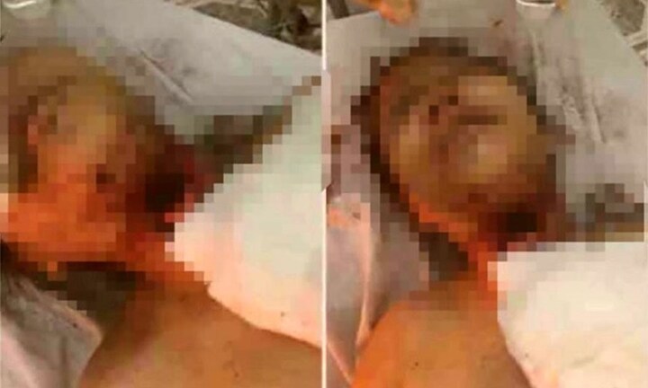 Xót xa hoàn cảnh bé gái bị thiếu niên 13 tuổi cưỡng hiếp, cứa cổ ở giữa cánh đồng