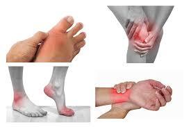 Đình chỉ lưu hành thuốc Nhức khớp tiêu bại hoàn trên toàn quốc