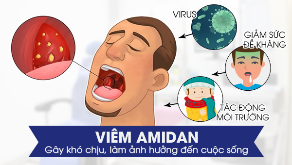 Lựa chọn địa chỉ cắt amidan được rất nhiều người bệnh quan tâm