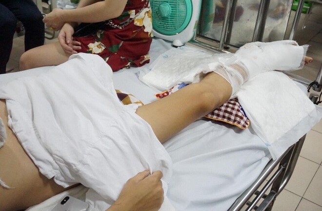 Thanh niên bị chém nát chân ở Phú Thọ: Lời khai lạnh gáy của tên cầm đầu