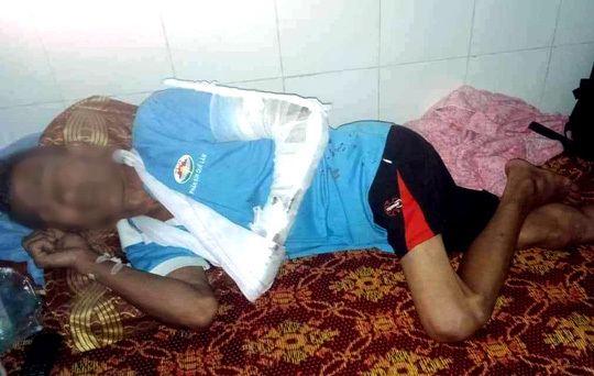 Vừa mãn hạn tù đã đánh gãy tay nạn nhân cũ để 