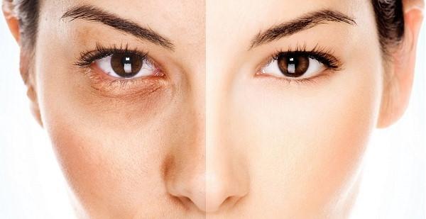 Những cảnh báo cho chị em “cuồng” dưỡng trắng cấp tốc cần biết!