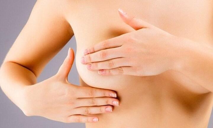 Ung thư vú giai đoạn 2: Đặc điểm và dấu hiệu của bệnh