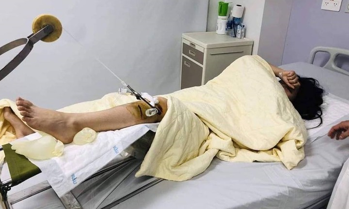 Vụ xe Range Rover đâm nữ sinh nguy kịch: Nếu nạn nhân có thương tật dưới 50% thì không khởi tố?