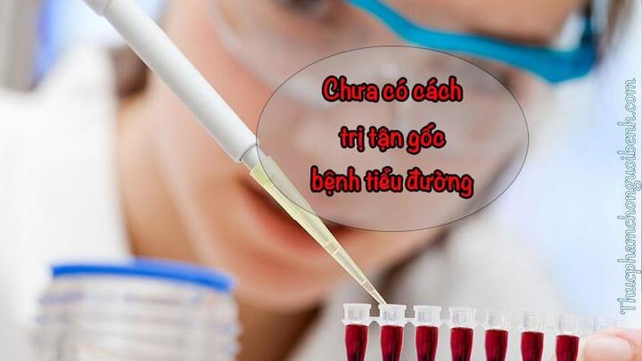 Bệnh tiểu đường Tuýp 2 là gì? Có chữa khỏi được không?