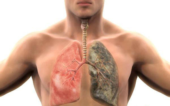 Cách để cứu lấy lá phổi bị tổn hại bởi thuốc lá