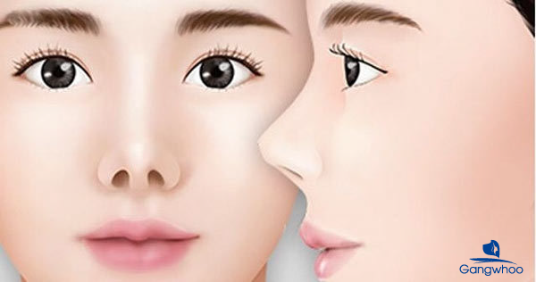 Sửa mũi hếch - Dáng mũi chuẩn nhân tướng học
