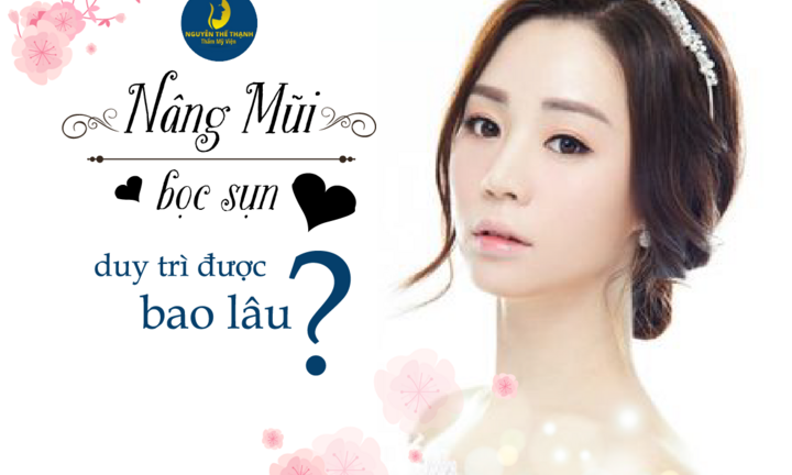 Nâng mũi bọc sụn duy trì được bao lâu?