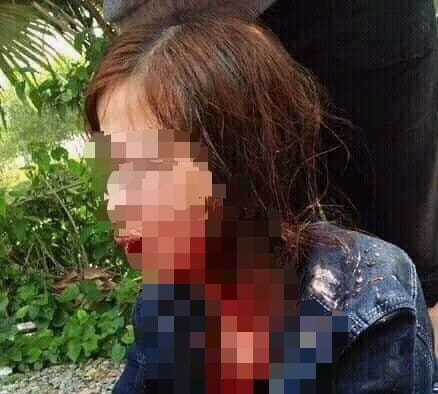 Triệu tập đối tượng dùng mảnh thủy tinh đâm vợ trọng thương trong đêm Giao thừa