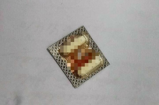 Nuốt 2 viên thuốc còn nguyên vỉ, người đàn ông chảy máu cổ họng phải nhập viện