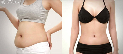 Điểm mặt những dịch vụ làm đẹp đang được ưa chuộng nhất dịp đầu năm