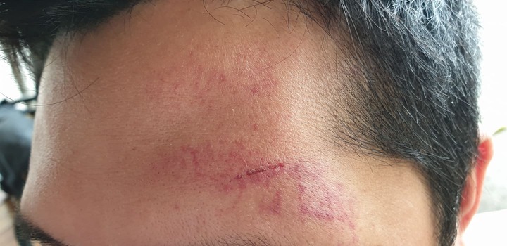 Hà Nội: Sau buổi làm việc với Đông y Tiến Hạnh, PV Thương Trường bị kẻ lạ mặt bất ngờ hành hung