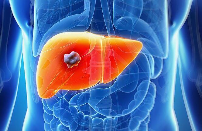 Tìm hiểu về ung thư gan và cách phòng tránh ung thư gan cho người Việt