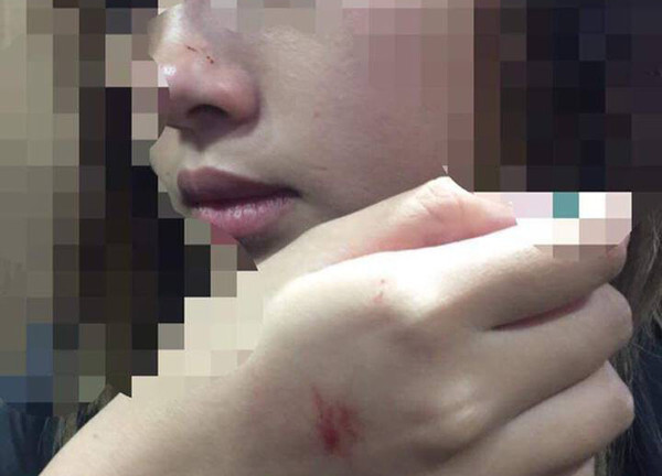 Tin tức thời sự 24h mới nhất ngày 11/3/2019: Nữ sinh bị cưỡng hôn trong thang máy muốn được xin lỗi công khai