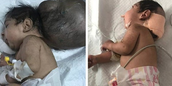 Cha ruột nhẫn tâm chôn sống con trai “2 đầu” khiến ai cũng đau lòng