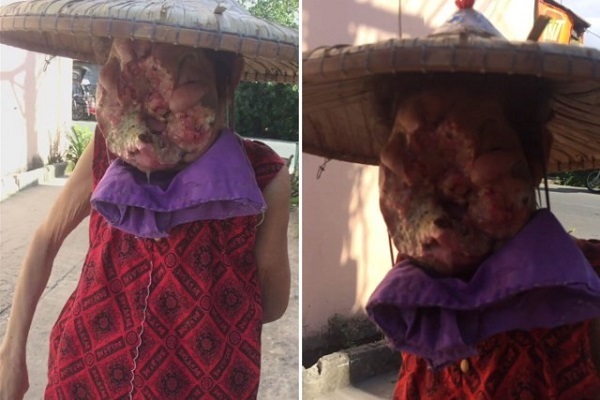 Tin tức đời sống ngày 14/3/2019: Xót xa người phụ nữ có 