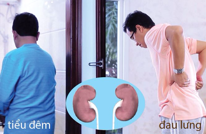 Người suy giảm chức năng thận, tiểu > 2 lần/đêm cần biết đến thứ này