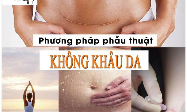 Phẫu thuật không khâu da – Giải pháp trọn vẹn cho lĩnh vực phẫu thuật thẩm mỹ