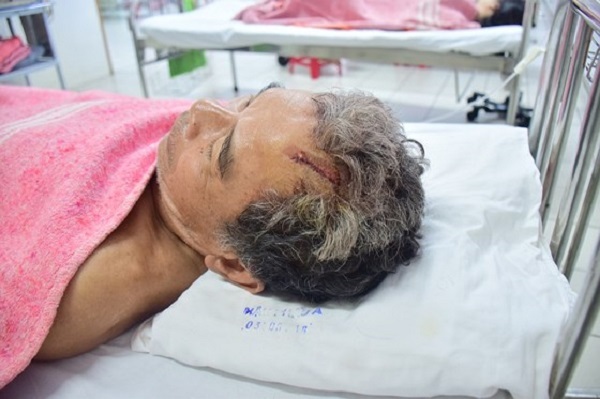 Đuổi