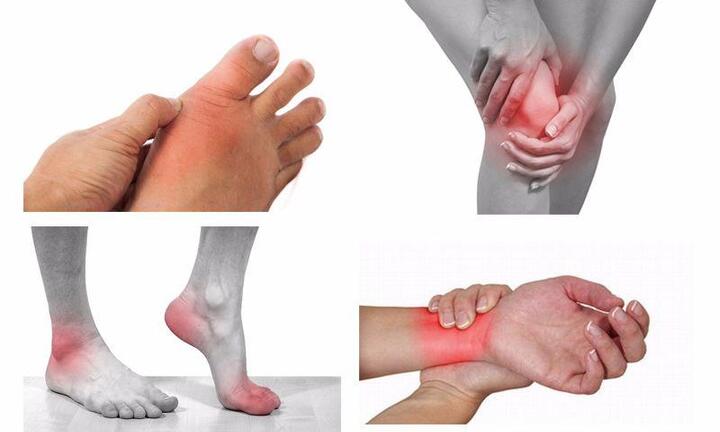 Cách trị viêm khớp dạng thấp bằng thảo dược Đông y