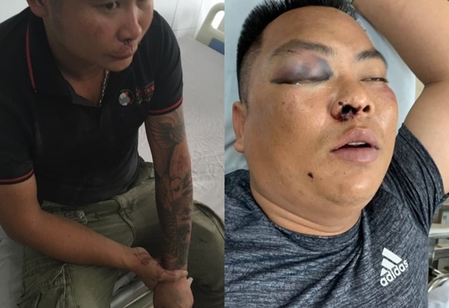 Vụ cựu đặc công đánh nhóm người đòi nợ thuê bầm dập: Hé lộ danh tính 3 nhân viên