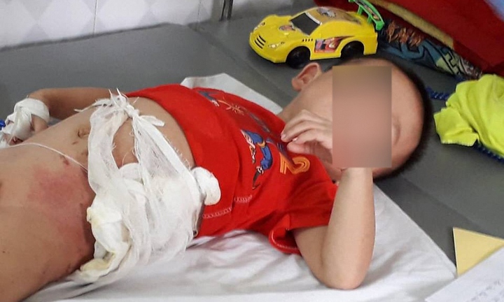 Hòa Bình: Tranh cãi chỉ vì quả dưa chuột, bác ruột ném cháu vào đống lửa