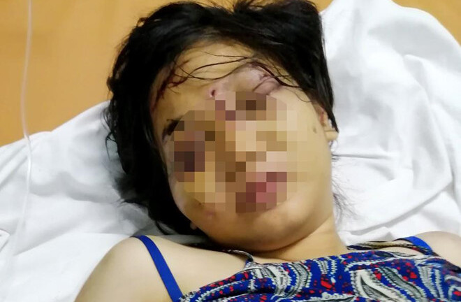 Vụ bà bầu 18 tuổi bị giam hơn nửa tháng, tra tấn đến sẩy thai: Ám ảnh lời kể rùng rợn của nạn nhân