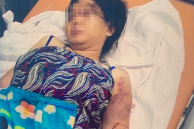 Vụ thai phụ 18 tuổi bị giam cầm, đánh sẩy thai: Nghi phạm đánh nạn nhân trong cơn phê ma túy