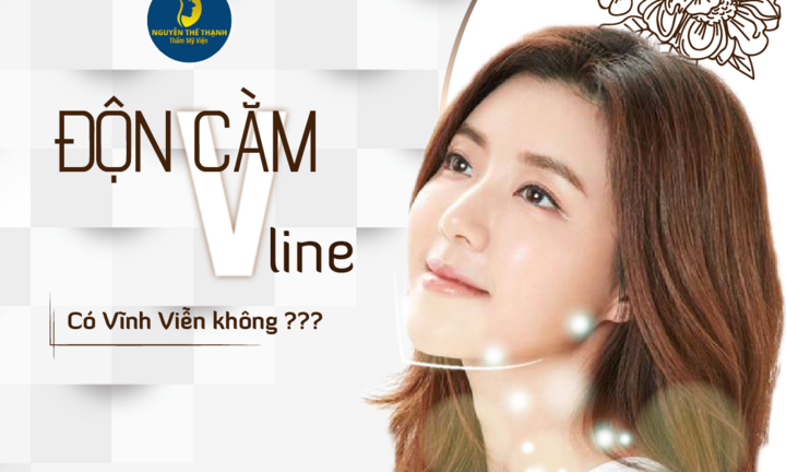 Độn cằm V-Line có vĩnh viễn không?