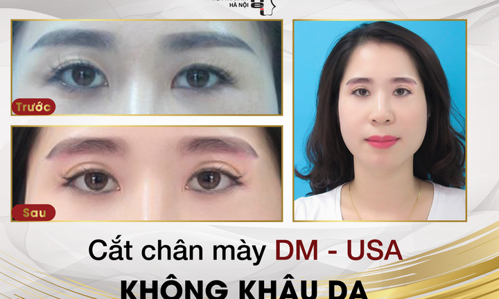 Cắt chân mày DM - USA