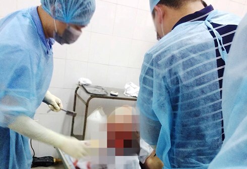 Vụ nguyên Đội phó QLTT chết khi bị tạm giam: Công an Nghệ An nói gì?