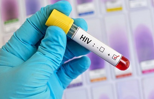 Tin tức đời sống mới nhất ngày 4/5/2019: 90 người nhiễm HIV do bác sĩ sử dụng kim tiêm có virus