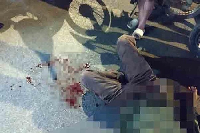 Vụ xe biển xanh gây tai nạn rồi bỏ trốn: Xuất hiện nhóm đồng nghiệp của tài xế đến thăm nạn nhân