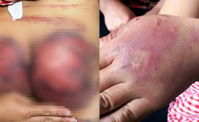 Vụ bố đánh con gái 8 tuổi dã man ở Thanh Hóa: Xử phạt hành chính 2,5 triệu đồng
