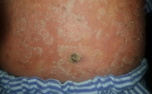 Tin tức đời sống mới nhất ngày 1/6/2019: Uống thuốc gia truyền, nam thanh niên mắc ung thư