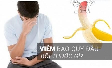 Dùng thuốc gì khi bị viêm bao quy đầu?