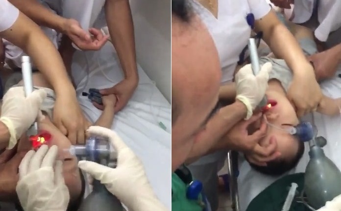 Bé trai 2 tuổi ngưng tim, ngưng thở vì hóc thạch rau câu được cứu sống thần kỳ