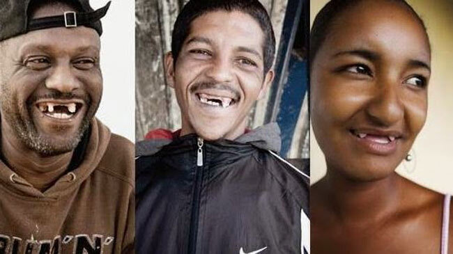 Video: Hoảng hốt với mốt nhổ hết răng cửa để gợi cảm hơn khi hôn