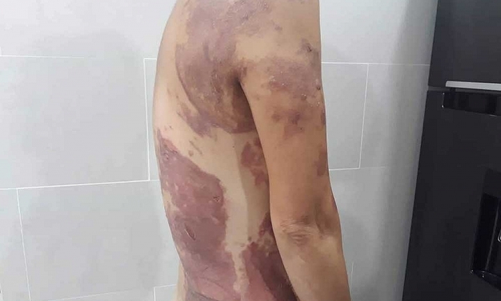 Tin tức pháp luật mới nóng nhất hôm nay 16/6/2019: Người phụ nữ tạt chảo dầu sôi vào hàng xóm mong được bỏ qua