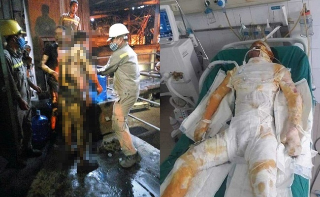 Hải Dương: Sụt lò luyện gang, 5 công nhân bị bỏng nặng