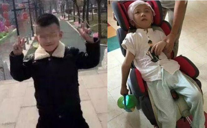 Bé trai 6 tuổi bị mẹ kế độc ác bạo hành phải sống đời thực vật