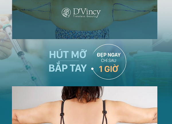 Bước đột phá trong công nghệ hút mỡ Amis Water Lipo tại D’vincy