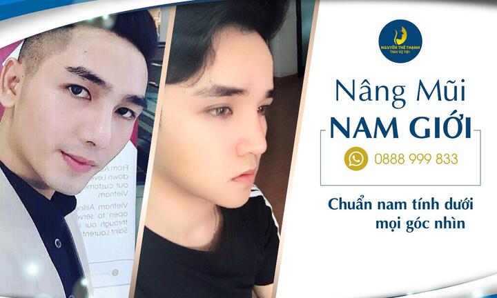 Nâng mũi nam giới: Chuẩn nam tính dưới mọi góc nhìn