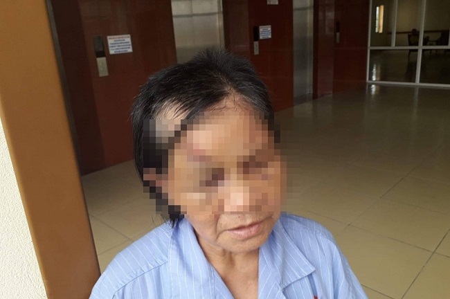 Quảng Ninh: Làm rõ nghi án cháu trai kéo lê, trói chân tay, đánh đập bà ngoại dã man